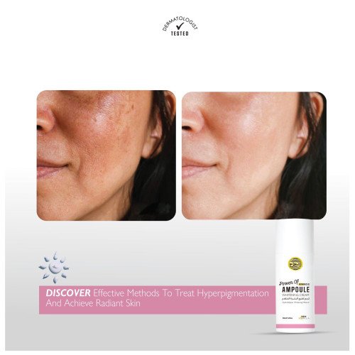 كريم تفتيح البشرة المتقدم 