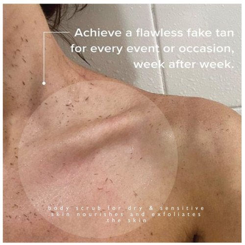 سنفرة شعاع الشمس 