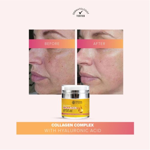 كريم الكولاجين 