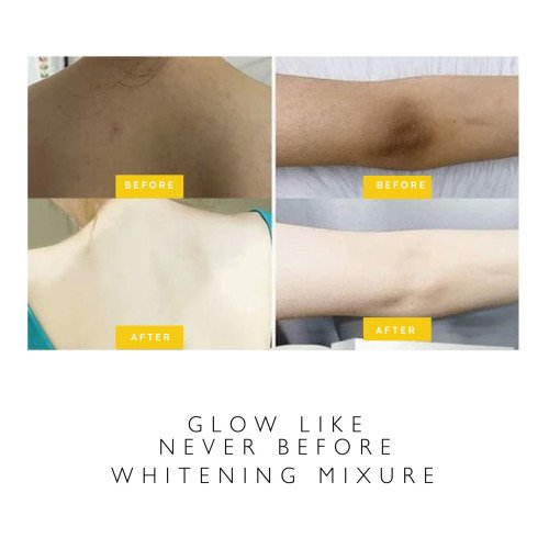 الهيدروبلابر