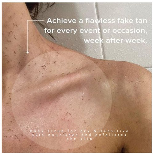 سنفرة شعاع الشمس