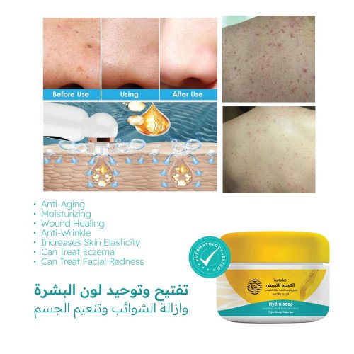 صابونية الهيدرو