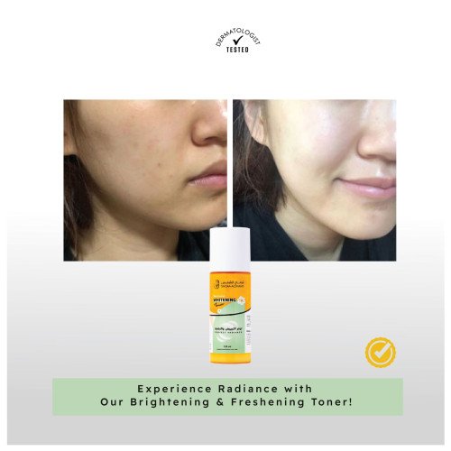 تونر التبييض والنضارة