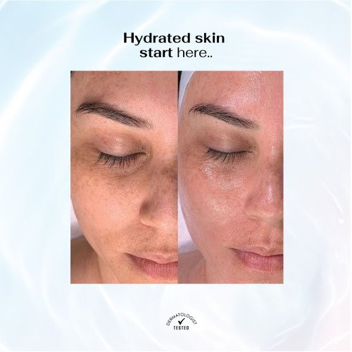 سيروم الهيالورونيك أسيد سيروم الهيالورونيك أسيد