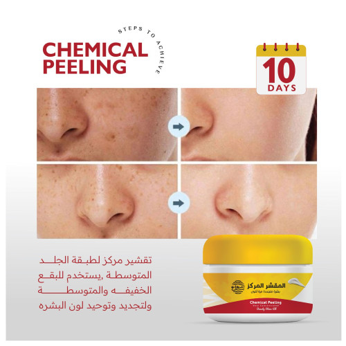 المقشر المركز 