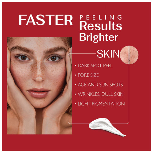 المقشر المركز 