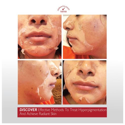 المقشر المركز جداً