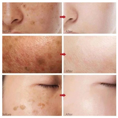 الهيدرو الخالص