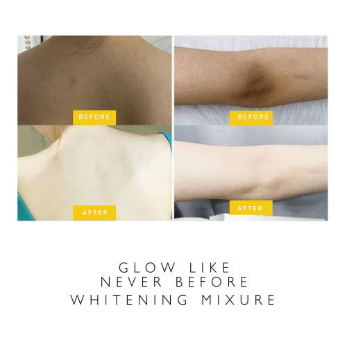 الهيدروبلابر