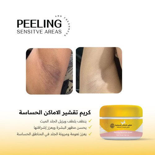 كريم تقشير المناطق الحساسة