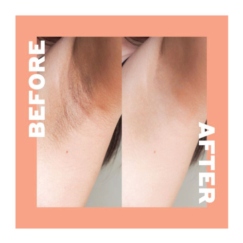 كريم تقشير المناطق الحساسة