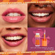 A glossy, a lip gloss, a dak, a lamb from NYX 11 A glossy, a lip gloss, a dak, a lamb from NYX 11
