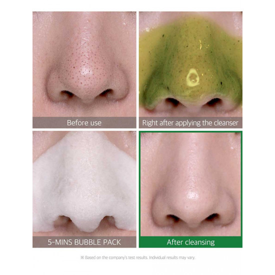 Some By Mi Bye Bye Blackhead 30 Days Miracle Green Tea Tox Bubble Cleanser