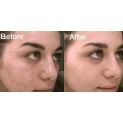 The Ordinary Alpha Arbutin 2% + HA - Concentrated Serum