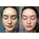 The Ordinary Azelaic Acid Suspension 10% (Brightening Formula)