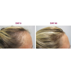 The Ordinary Multi-Peptide Serum for Hair Density