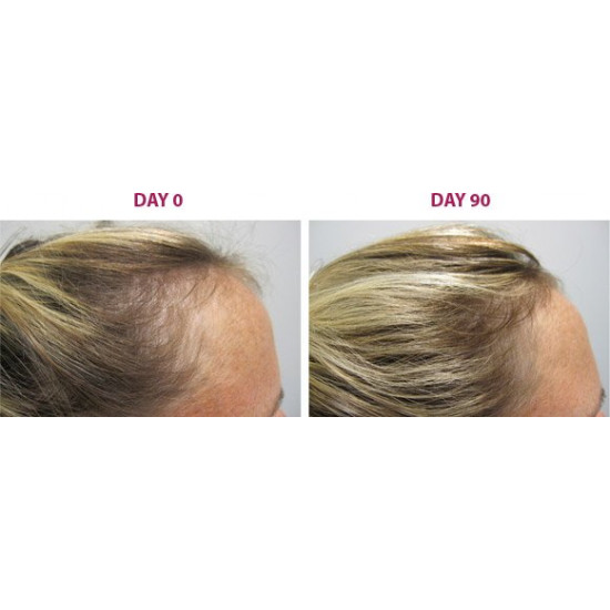 The Ordinary Multi-Peptide Serum for Hair Density The Ordinary Multi-Peptide Serum for Hair Density