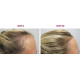 The Ordinary Multi-Peptide Serum for Hair Density The Ordinary Multi-Peptide Serum for Hair Density