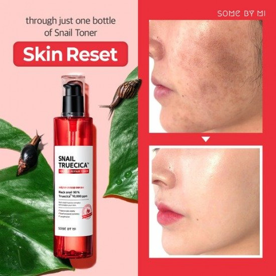 Some By Mi Snail Truecica Miracle Repair Toner (135ml)