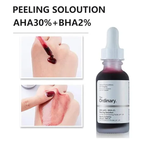 The Ordinary – AHA 30% + BHA 2% Exfoliating Solution – 30ml