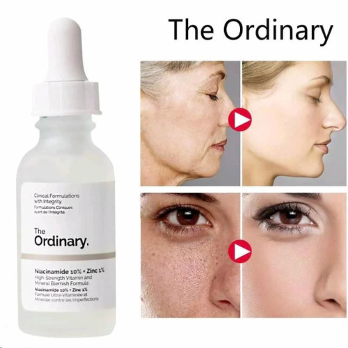 The Ordinary Niacinamide 10% + Zinc 1% Advanced Blemish & Sebum Control Serum – 30ml