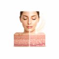 Skin brightening and radiance